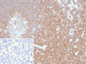 CD48 Antibody (Pan Leukocyte Marker)