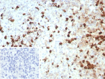 S100A12 Antibody / CGRP