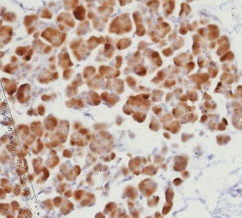 RORC Antibody / ROR gamma