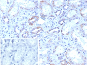 RORC Antibody / ROR gamma