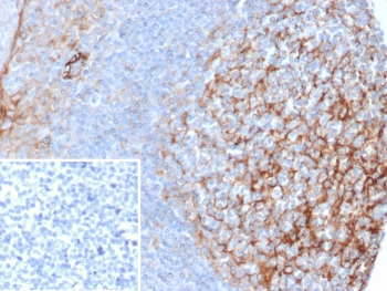 ICAM-1 Antibody / CD54