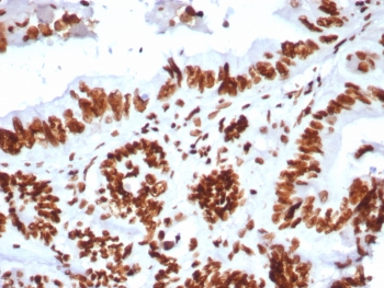 SMARCA4 Antibody / BRG1