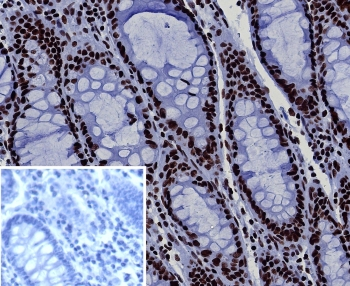 BRG1 Antibody / SMARCA4