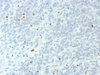 BRG1 Antibody / SMARCA4