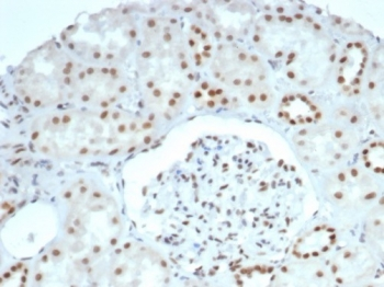 BRG1 Antibody / SMARCA4