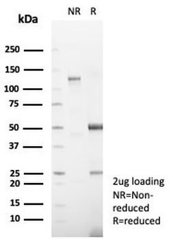Desmoglein-3 Antibody