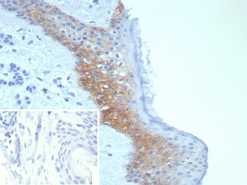Desmoglein-3 Antibody