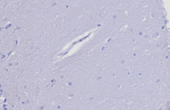 TIMP2 Antibody