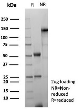 GFAP Antibody / Glial Fibrillary Acidic Protein