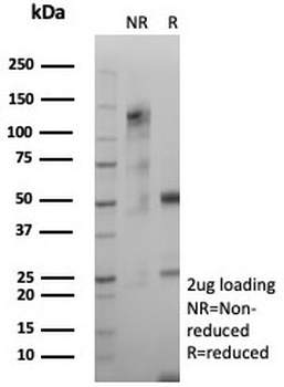 GFAP Antibody / Glial Fibrillary Acidic Protein