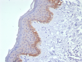 Cytokeratin 15 Antibody / KRT15
