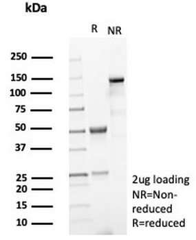 Cytokeratin 15 Antibody / KRT15
