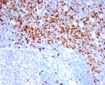 Topoisomerase II alpha Antibody / TOP2A