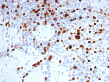 Topoisomerase II alpha Antibody / TOP2A