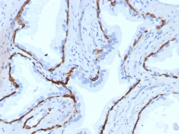 Recombinant Keratin 14 Antibody / Cytokeratin 14 / KRT14