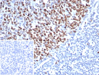 Recombinant TOP2A Antibody / Topoisomerase II alpha