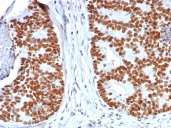 Recombinant TP53 Antibody / p53