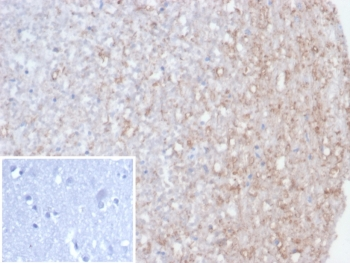 Calretinin / Calbindin 2 Antibody