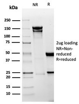 Recombinant Mesothelin Antibody / MSLN