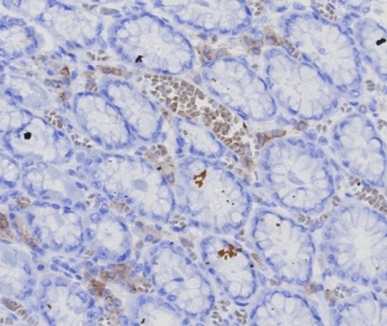 BCMA Antibody / CD269 / TNFRSF17