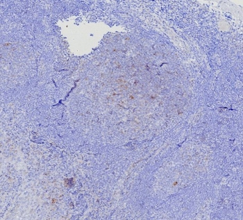 BCMA Antibody / CD269 / TNFRSF17