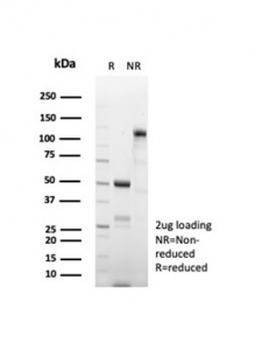 BCMA Antibody / CD269 / TNFRSF17