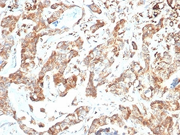 CD269 Antibody / BCMA / TNFRSF17