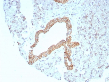 BCMA Antibody / CD269 / TNFRSF17