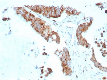 BCMA Antibody / CD269 / TNFRSF17