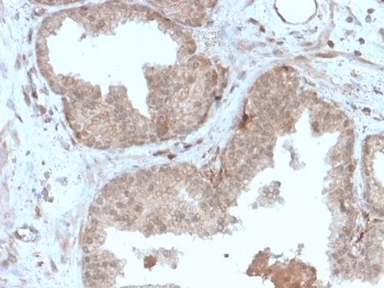 Major Vault Protein Antibody / MVP