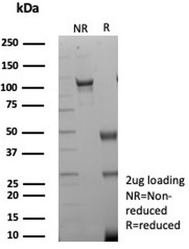 CKB Antibody / Creatine kinase B