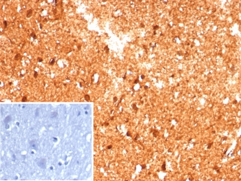 CKB Antibody / Creatine kinase B