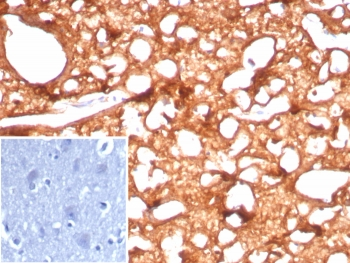 CKB Antibody / Creatine kinase B