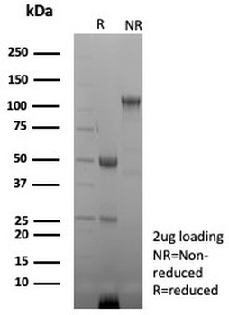 CKB Antibody / Creatine kinase B