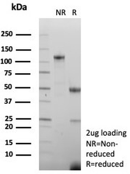 CKB Antibody / Creatine kinase B