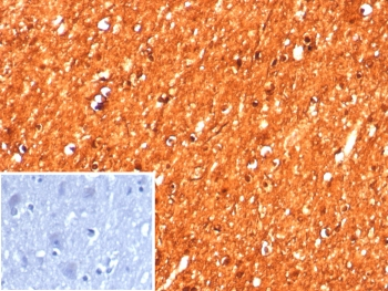CKB Antibody / Creatine kinase B