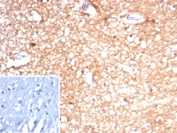 CKB Antibody / Creatine kinase B