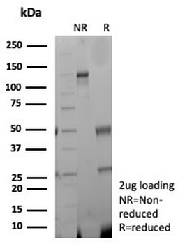 CKB Antibody / Creatine kinase B
