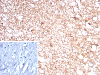 CKB Antibody / Creatine kinase B