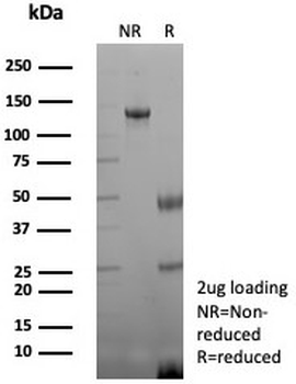 CKB Antibody / Creatine kinase B