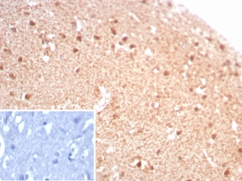 CKB Antibody / Creatine kinase B