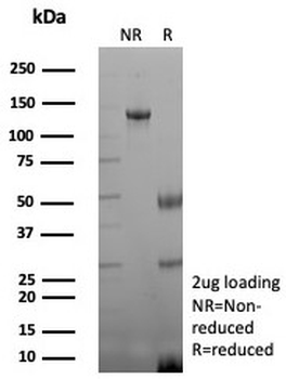 CKB Antibody / Creatine kinase B