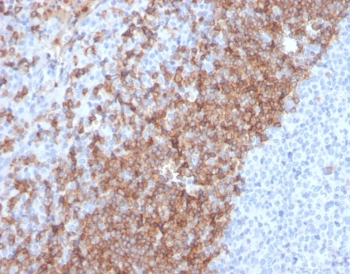 IgD Heavy Chain Antibody