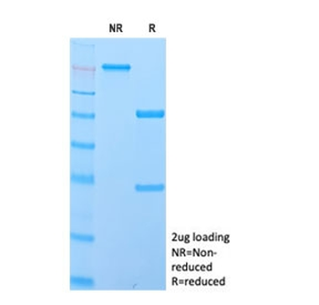 IgD Heavy Chain Antibody