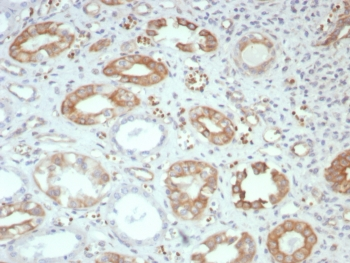 FGF23 Antibody / Fibroblast Growth Factor 23