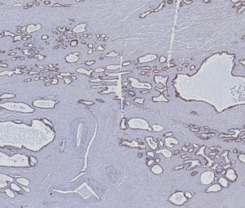 Cytokeratin 5/6 Antibody