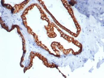 Cytokeratin 18 Antibody