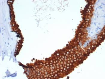 Cytokeratin 18 Antibody