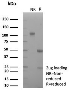 CD163 Antibody