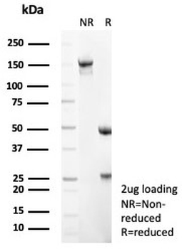 NCAM / CD56 Antibody